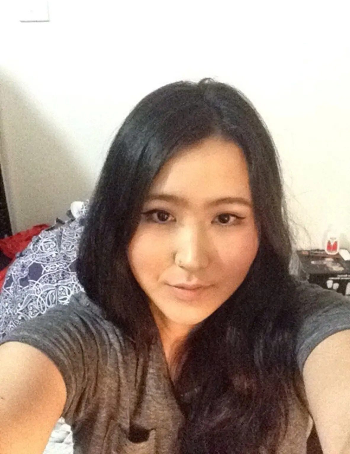 phau thuat tham my giong Kim Kardashian anh 1