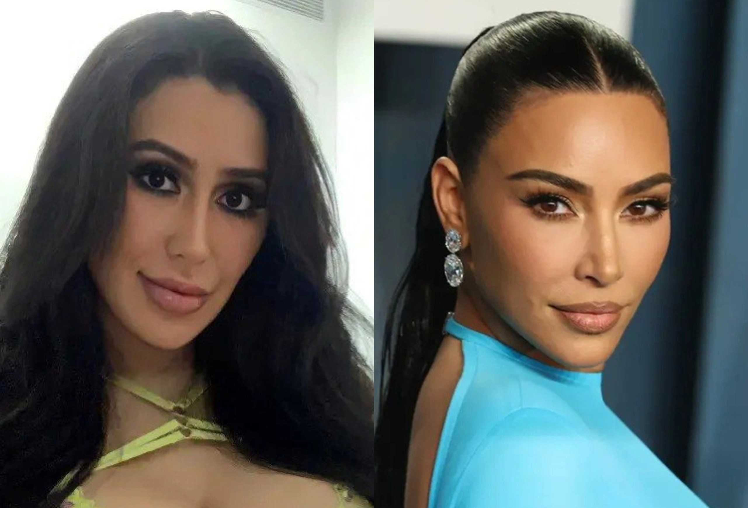 Phau thuat 15 lan de giong Kim Kardashian hinh anh