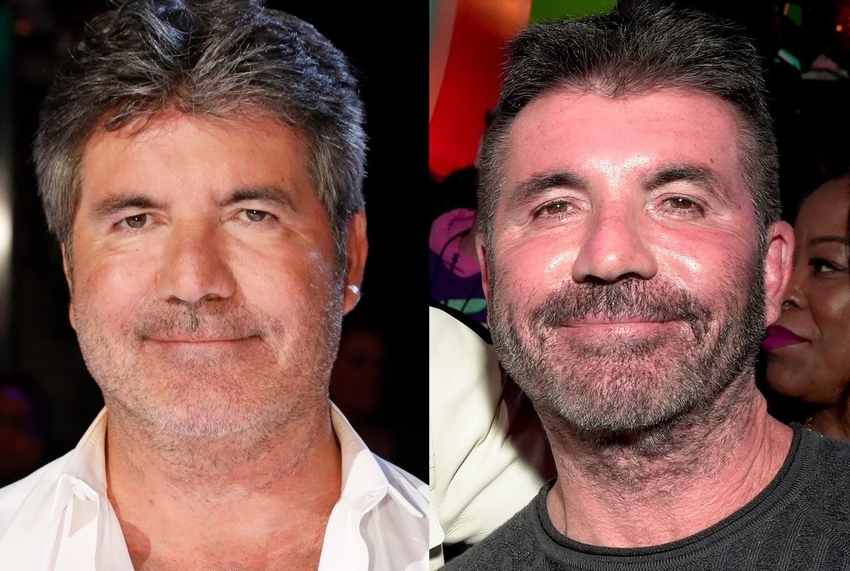 Guong mat Simon Cowell thay doi 'khong the nhan ra' hinh anh