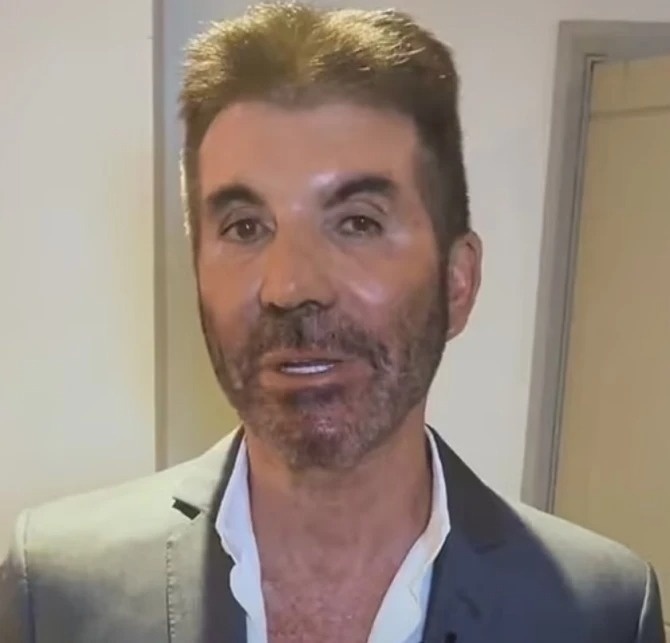 Simon Cowell tiem botox anh 8