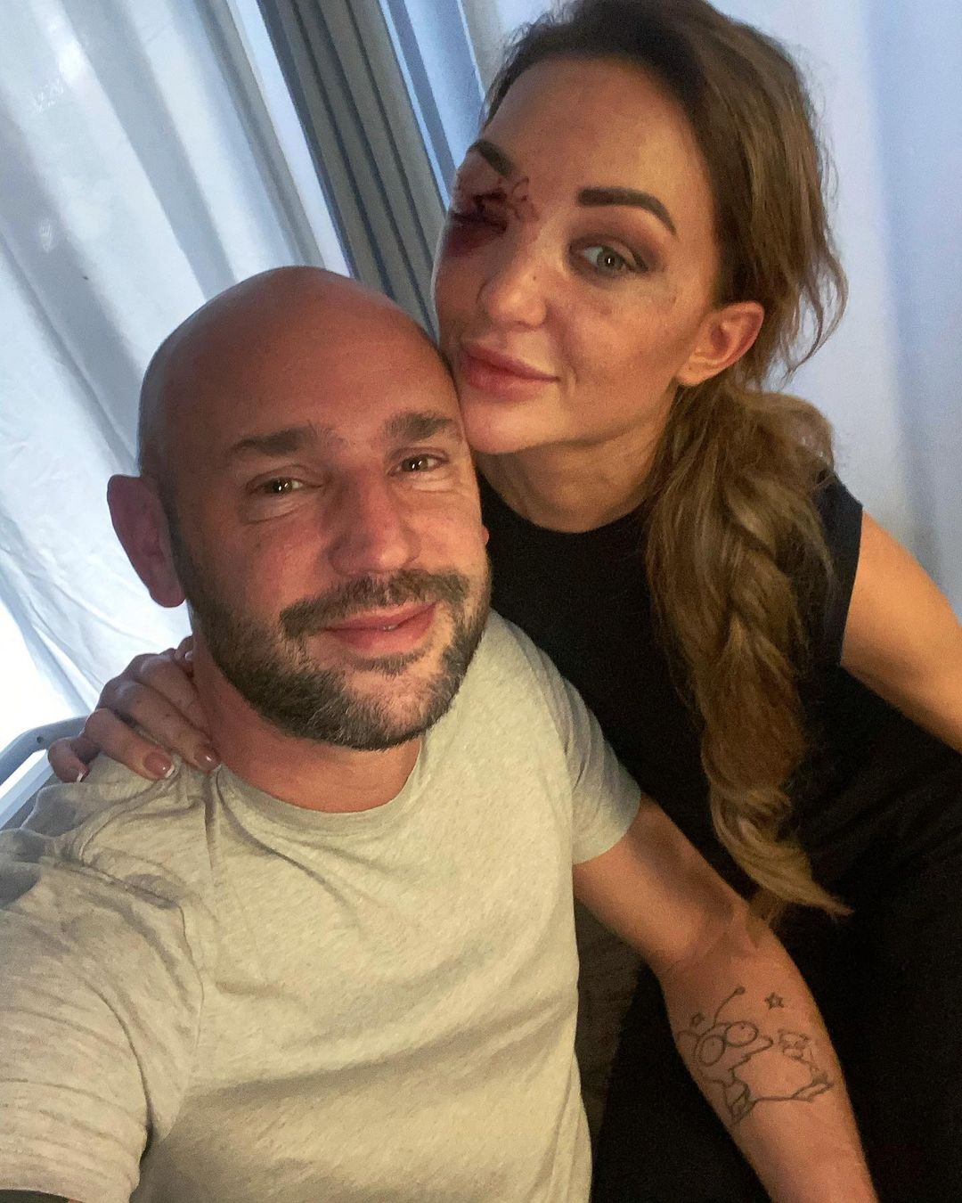 Hoa hau Hoan vu anh 1