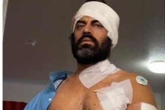 Nam dien vien bi chem nhieu nhat o phong gym hinh anh