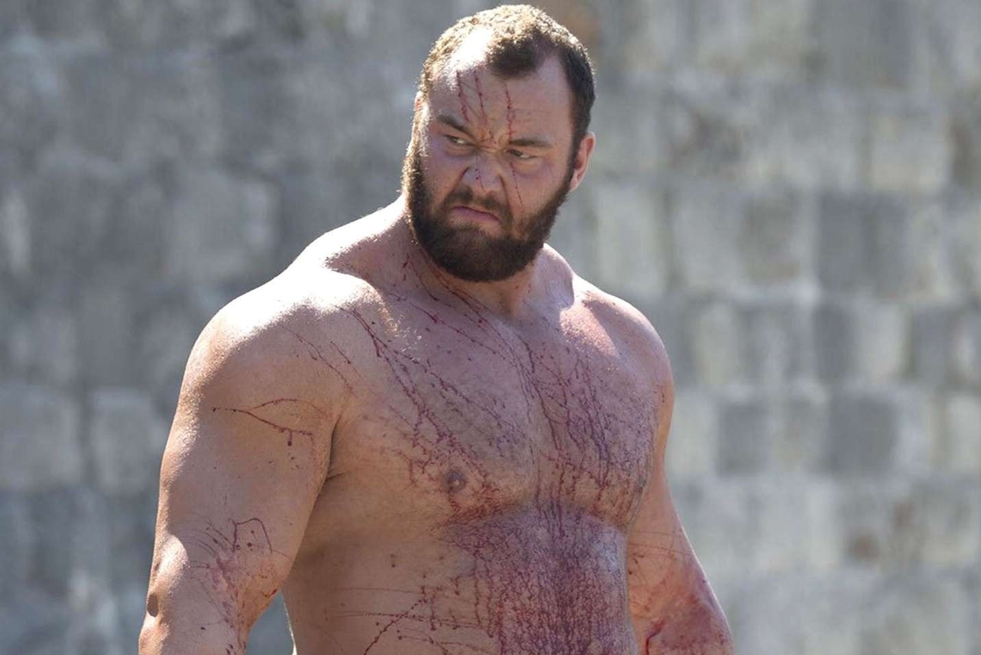 Tai tu 'Game of Thrones' bi chan thuong nang khi cu ta hinh anh