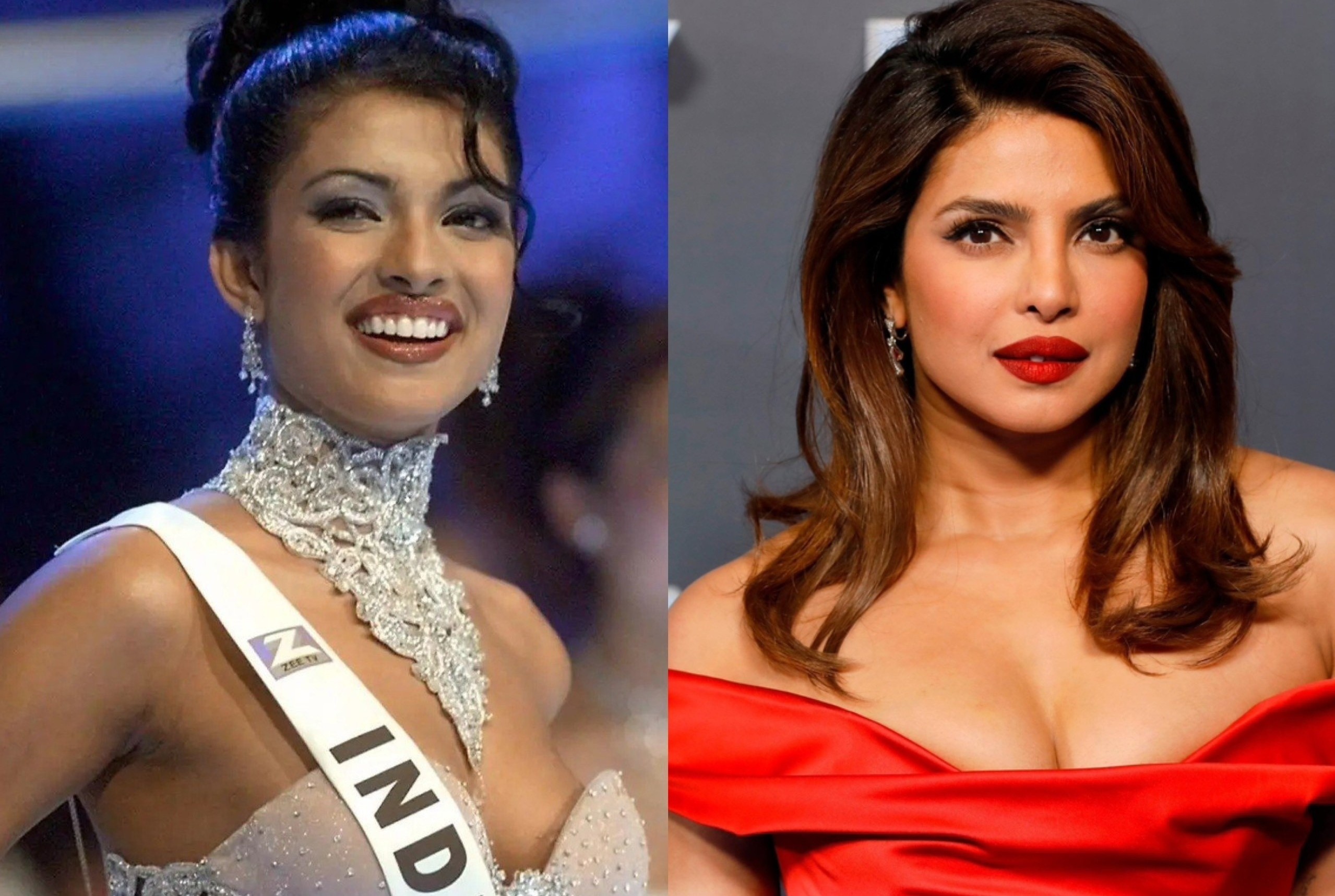 Hoa hau The gioi tram cam vi phau thuat tham my hong hinh anh