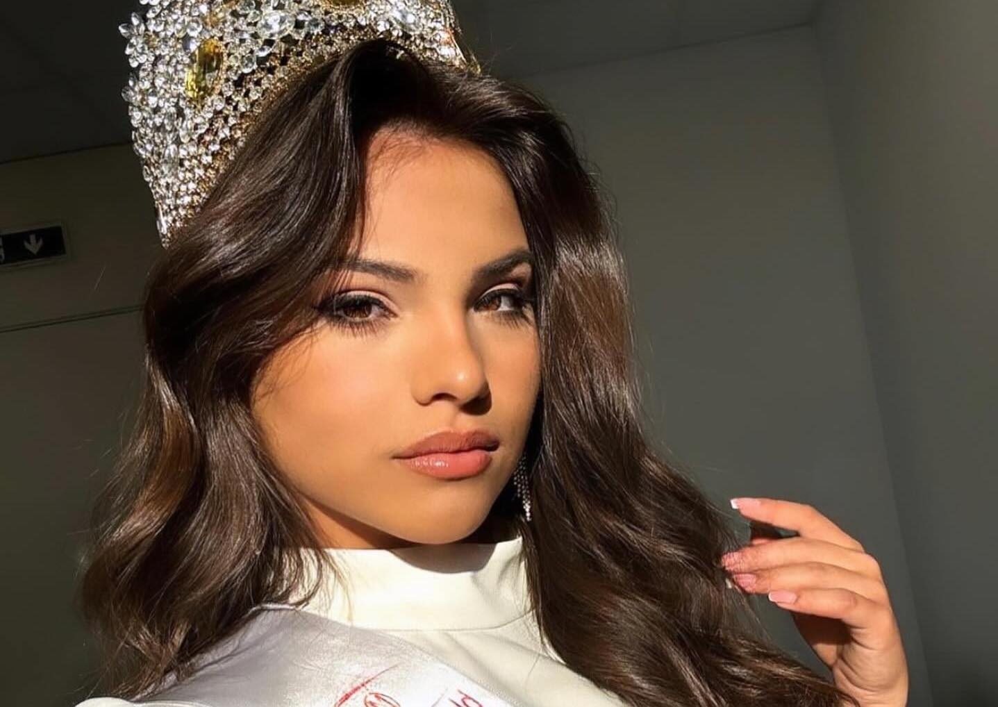 Anh doi thuong cua co gai 16 tuoi thi Miss World hinh anh