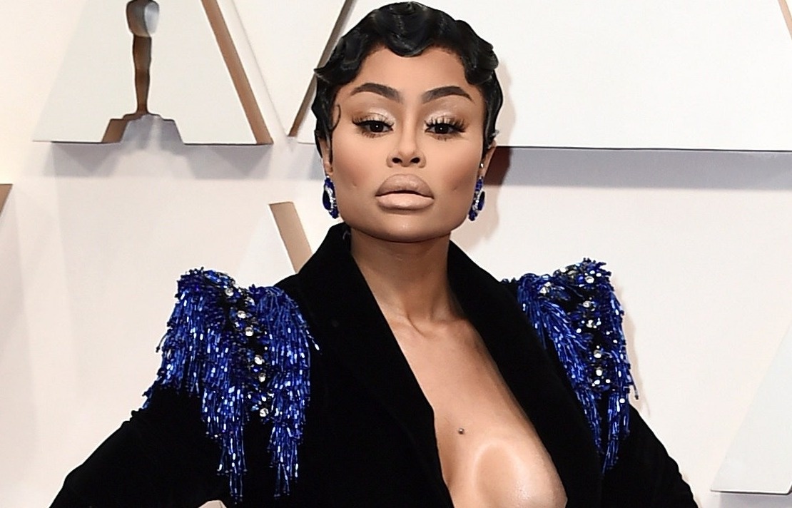 Trang phuc xau nhat tham do Oscar hinh anh