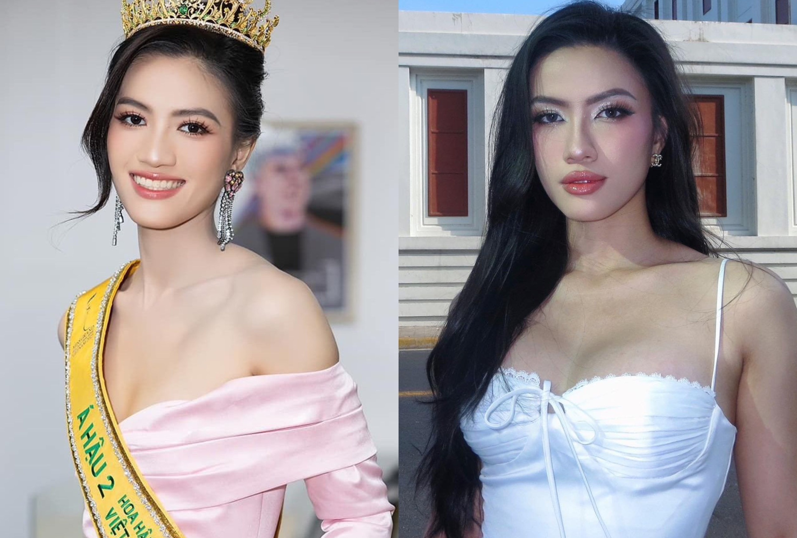 Nhan sac cua A hau Minh Nhan sau khi 'dao keo' hinh anh