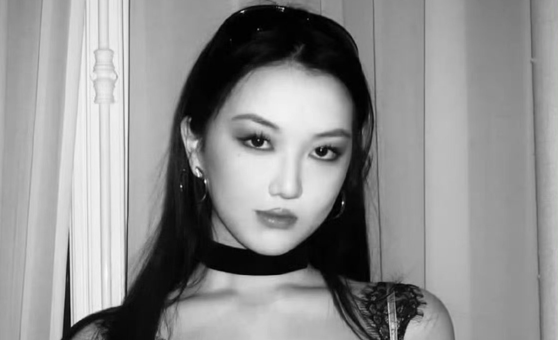 Con gai Vuong Phi phau thuat chinh moi ho ham ech hinh anh