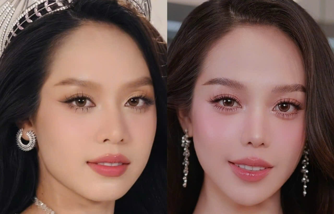 Hoa hau Thanh Thuy len tieng ve viec lam dung phau thuat tham my hinh anh