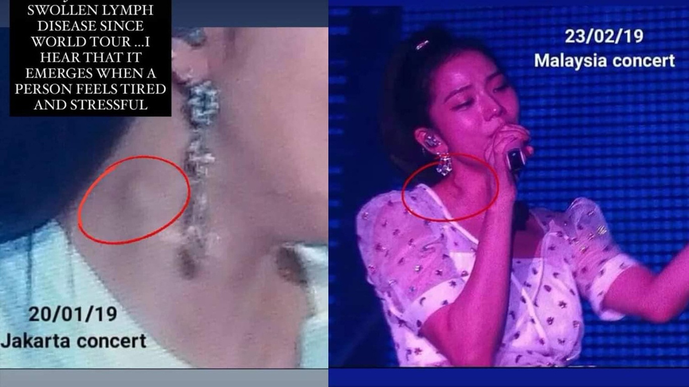 Hach bach huyet o co Jisoo sung to bat thuong anh 2