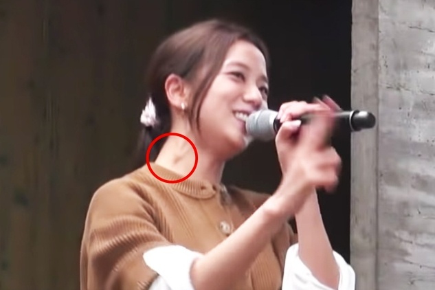 Hach bach huyet o co Jisoo sung to bat thuong hinh anh