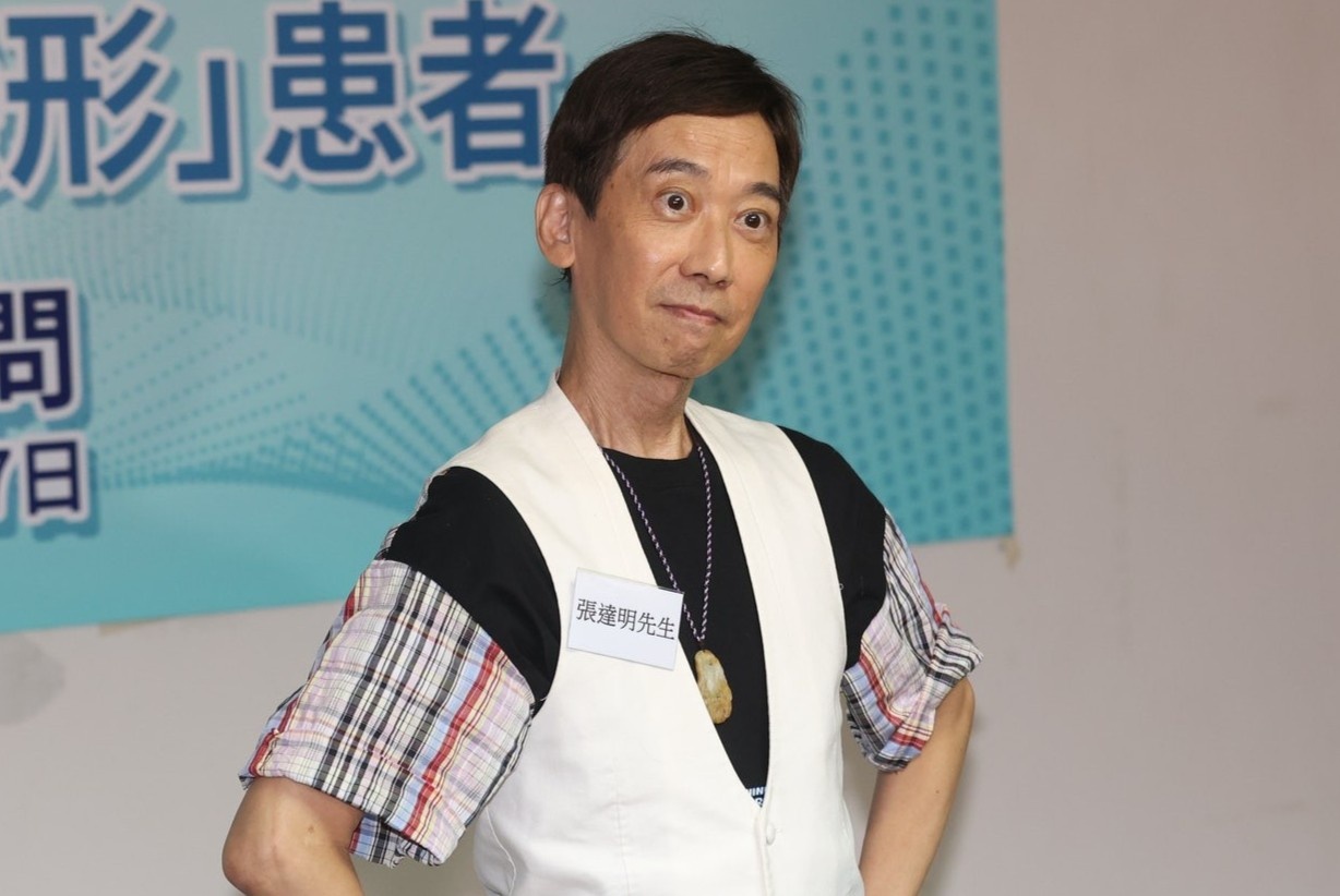 Hanh trinh chua ung thu cua danh hai Hong Kong hinh anh