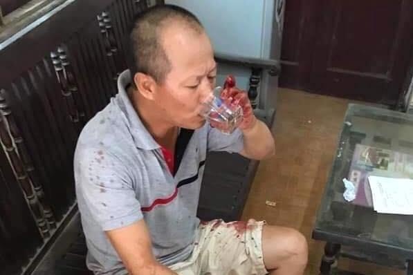 Ke tham sat gia dinh em trai binh tinh vao uong nuoc sau khi gay an hinh anh