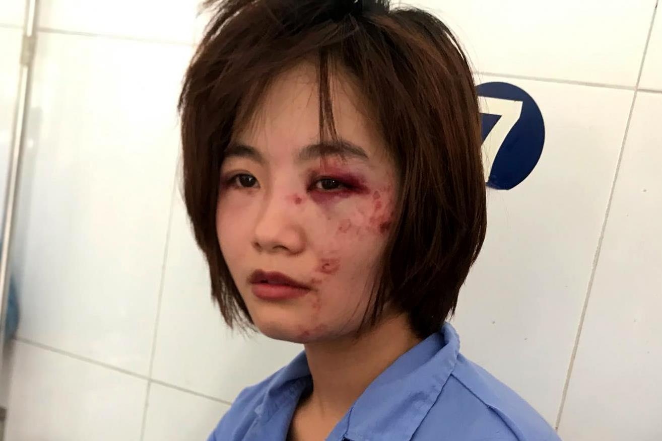 Canh sat lam ro nhom danh nu phu xe buyt nhap vien hinh anh