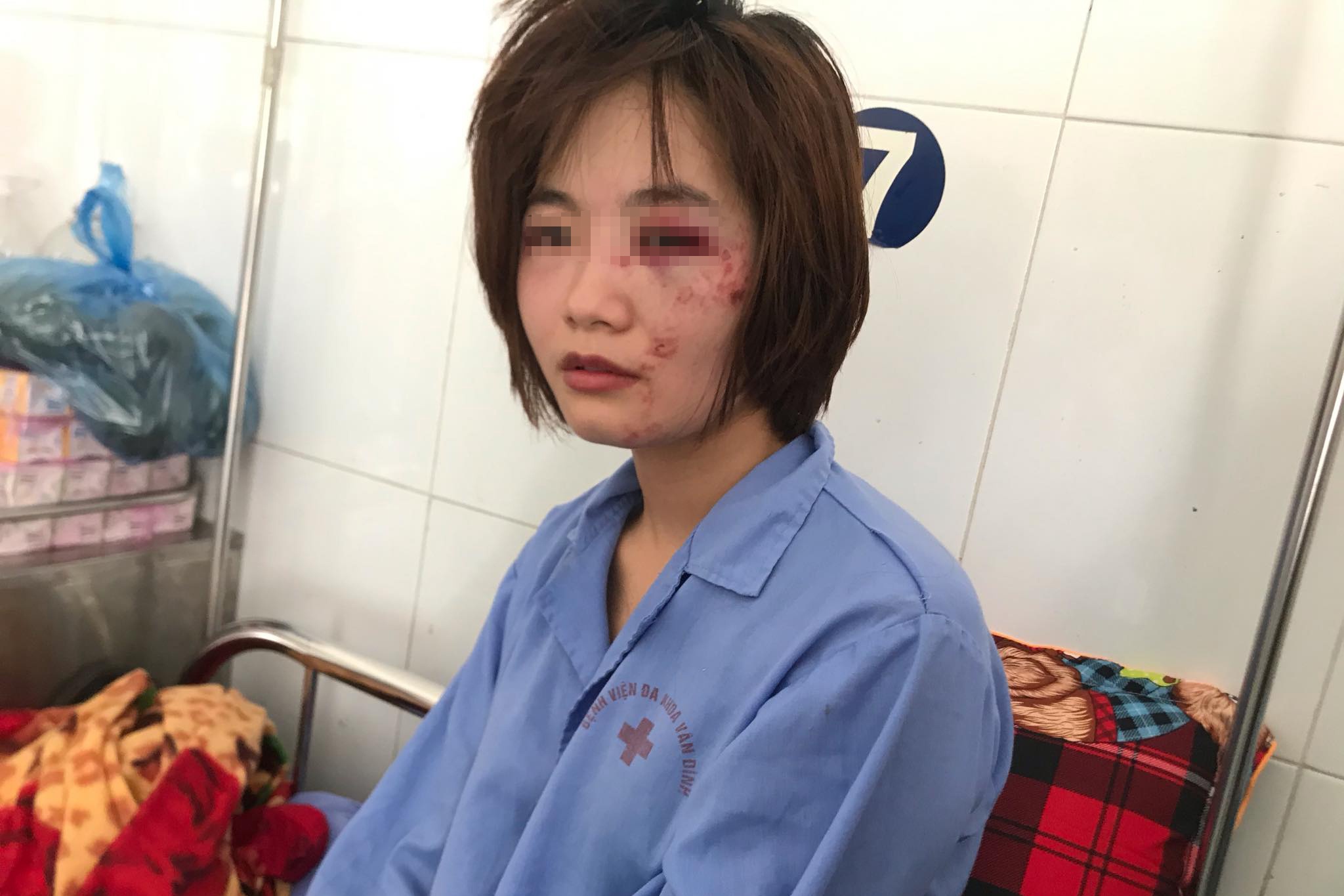 lam ro nhom hanh hung nu phu xe buyt anh 1