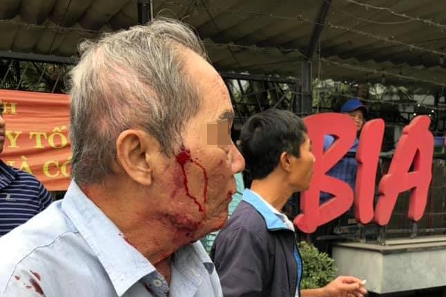 Ngay thu 2 lam xe om, cu ong 80 tuoi bi danh gay xuong hinh anh