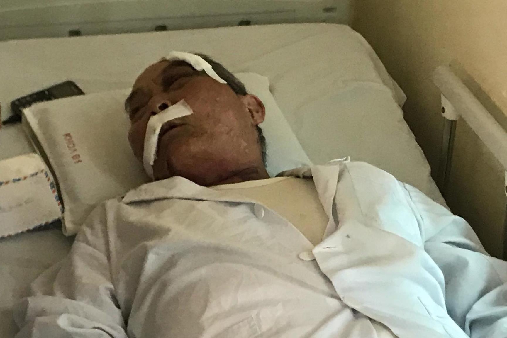 'Cau ta dung sung cao su ban vao dau va nguc toi' hinh anh