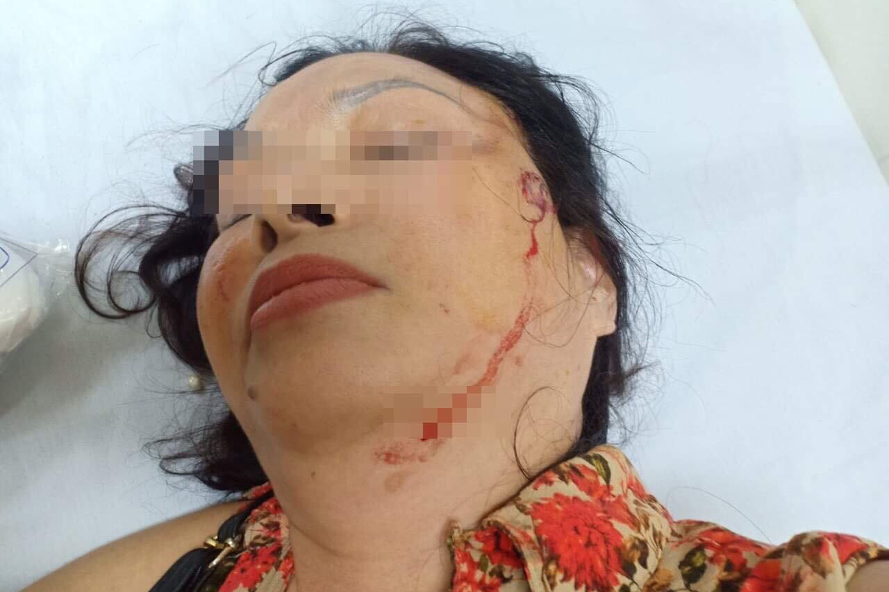 Chong cu chui danh gia dinh vo anh 1