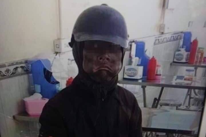 Truy tim nhung nguoi dan ong mac do den, cam dau ga di xin hinh anh