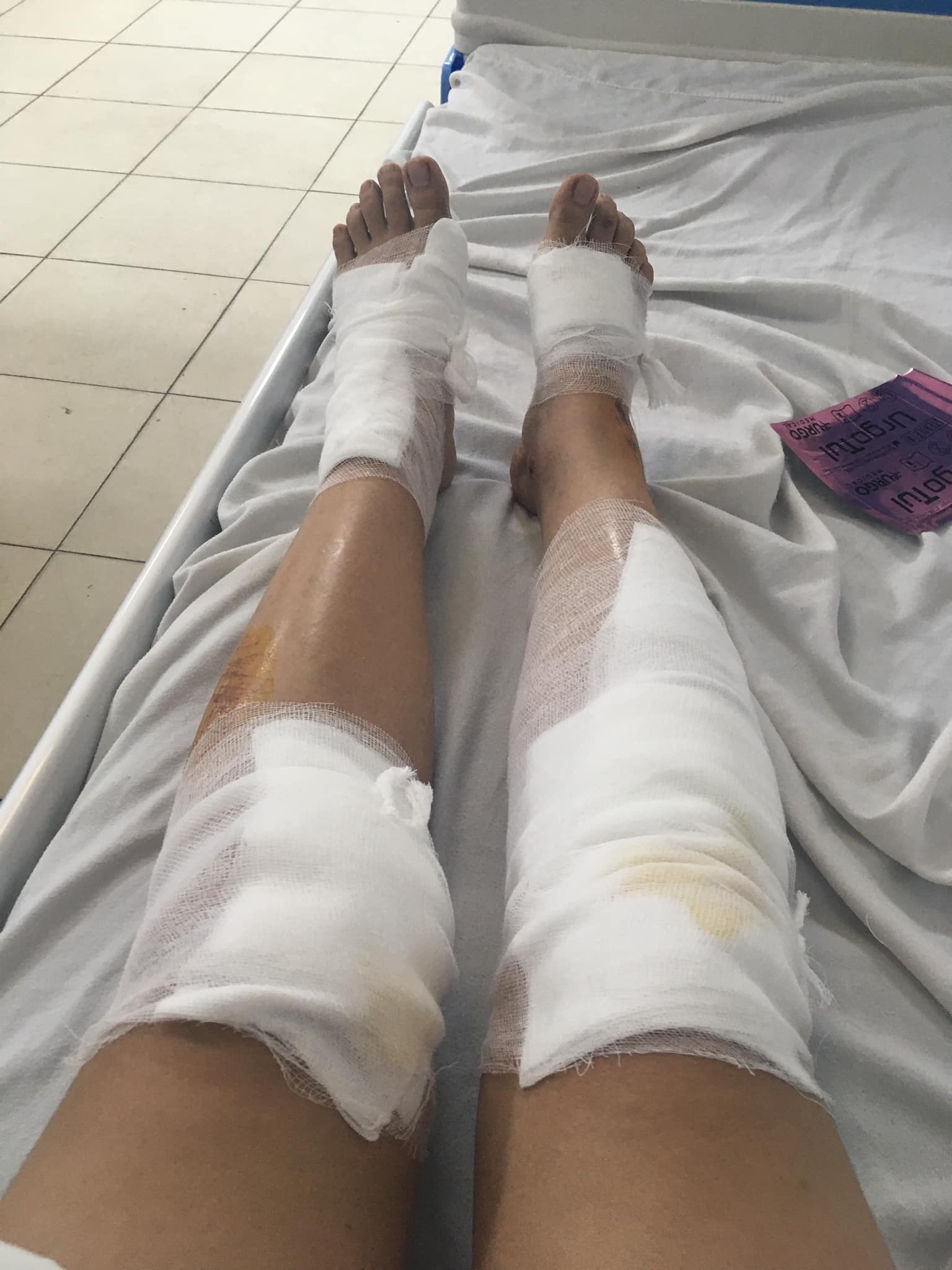 Người phụ nữ bị cướp kéo lê ảnh 1 Nguoi phu nu bi cuop keo le anh 1