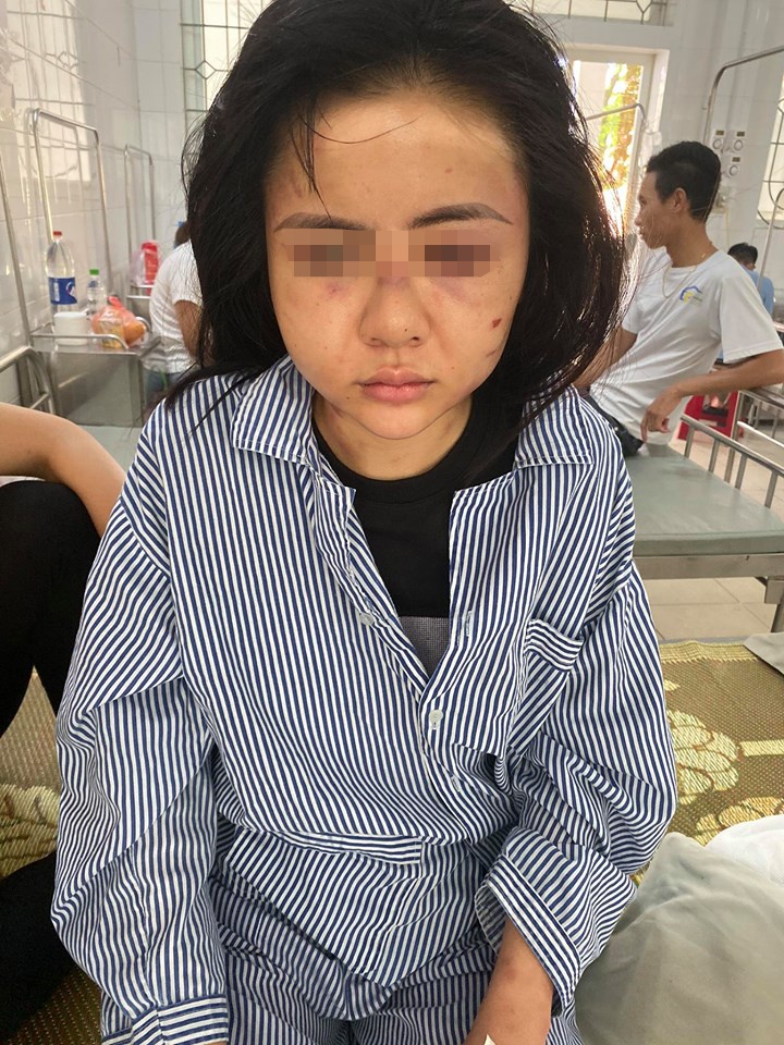 Thanh niên đánh cô gái vì ghen ảnh 2 Thanh nien danh co gai vi ghen anh 2