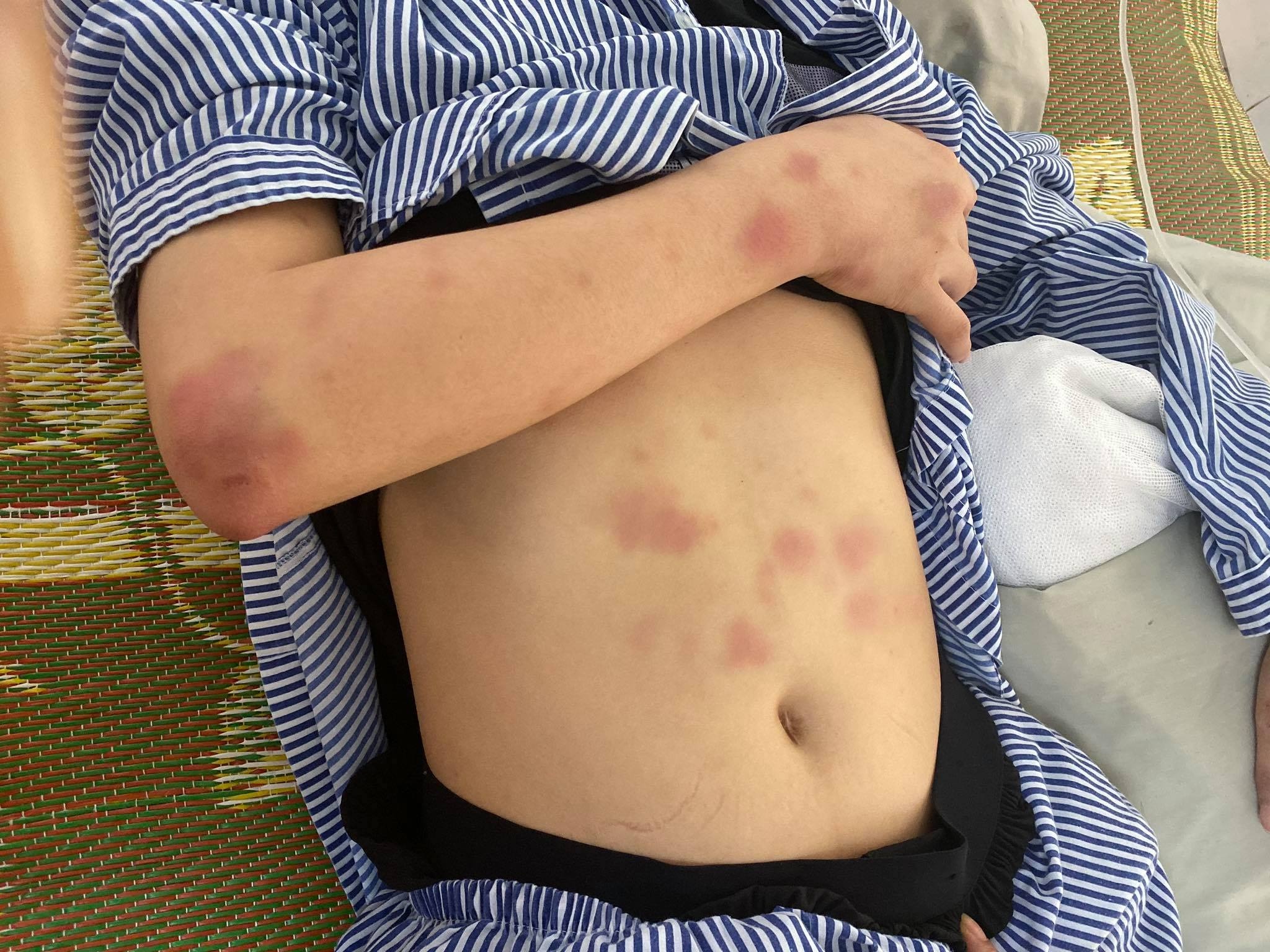 Thanh niên đánh cô gái vì ghen ảnh 3 Thanh nien danh co gai vi ghen anh 3