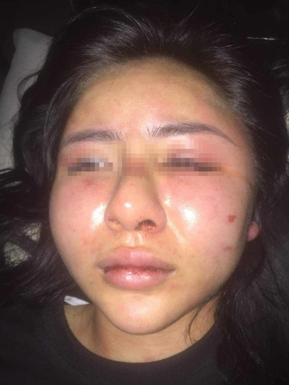 Thanh niên đánh cô gái vì ghen ảnh 2 Thanh nien danh co gai vi ghen anh 2