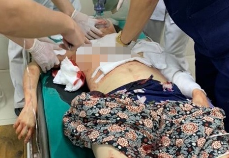 Chong truy sat 3 nguoi gia dinh vo roi tu tu hinh anh