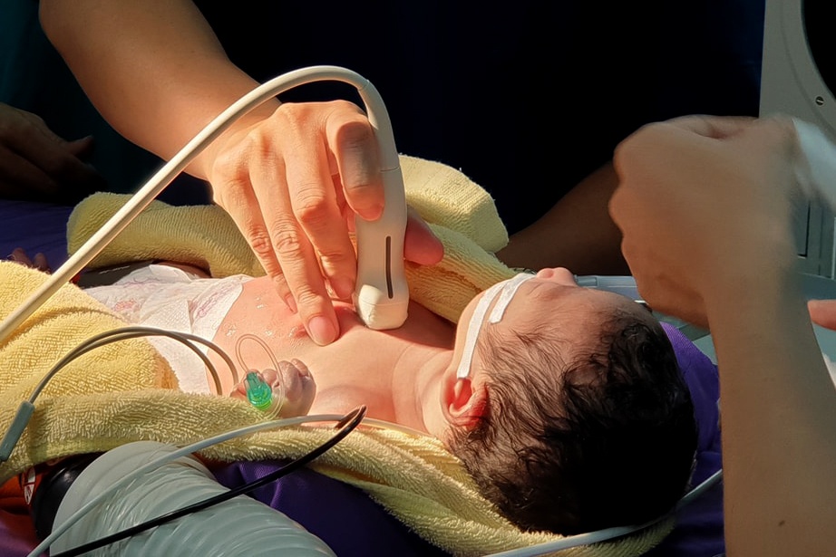 Be gai so sinh bi bo o ruong, da bong vi chay nang hinh anh