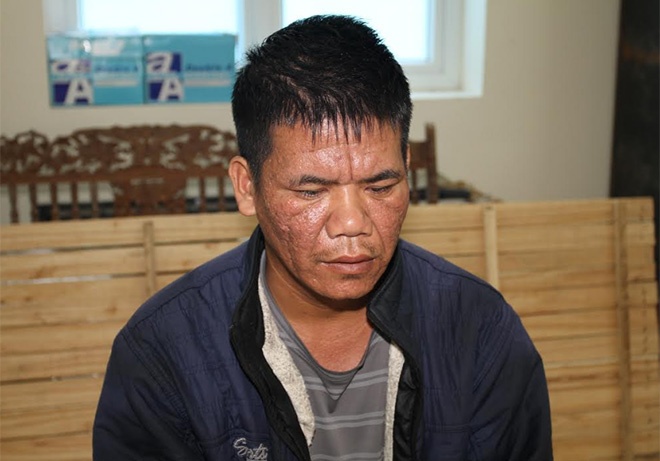 Chết trong trạng thái bị trói trong rừng ảnh 1 Chet trong trang thai bi troi trong rung anh 1