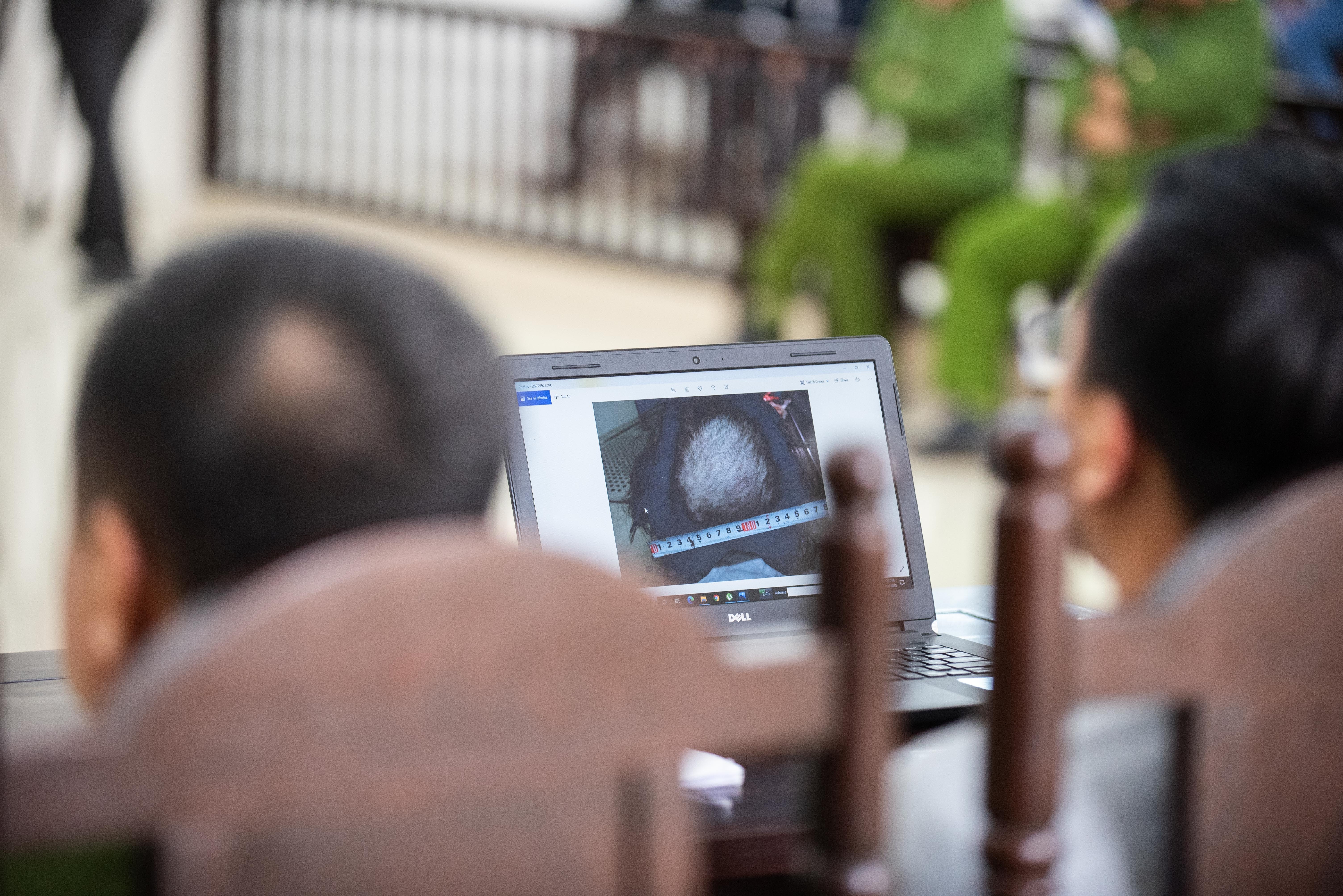 Bao hanh con gai o Ha Noi anh 7