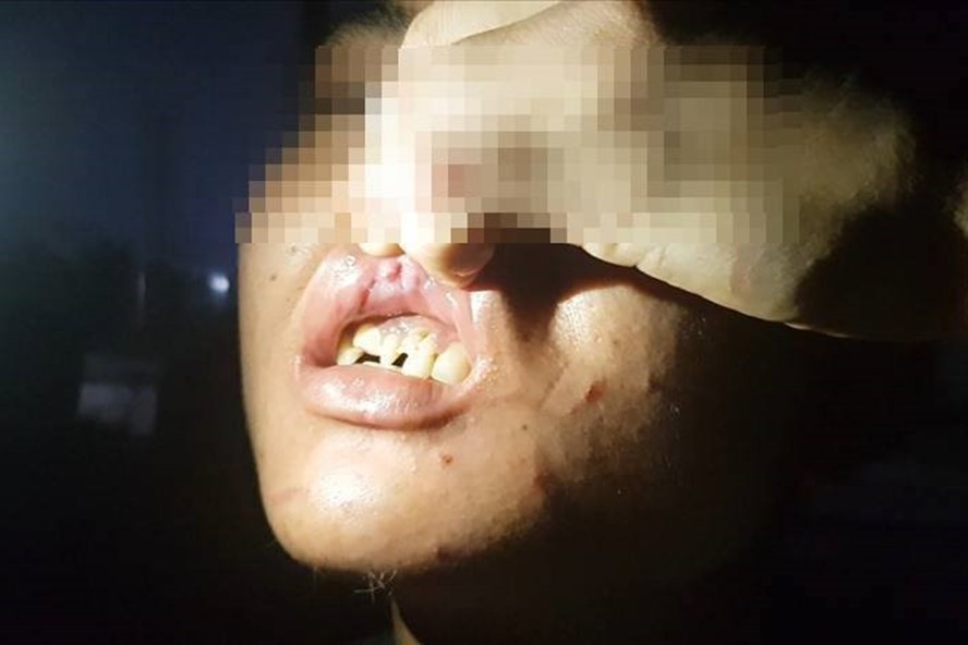 Chu quan banh xeo bi to hanh ha nhan vien hinh anh