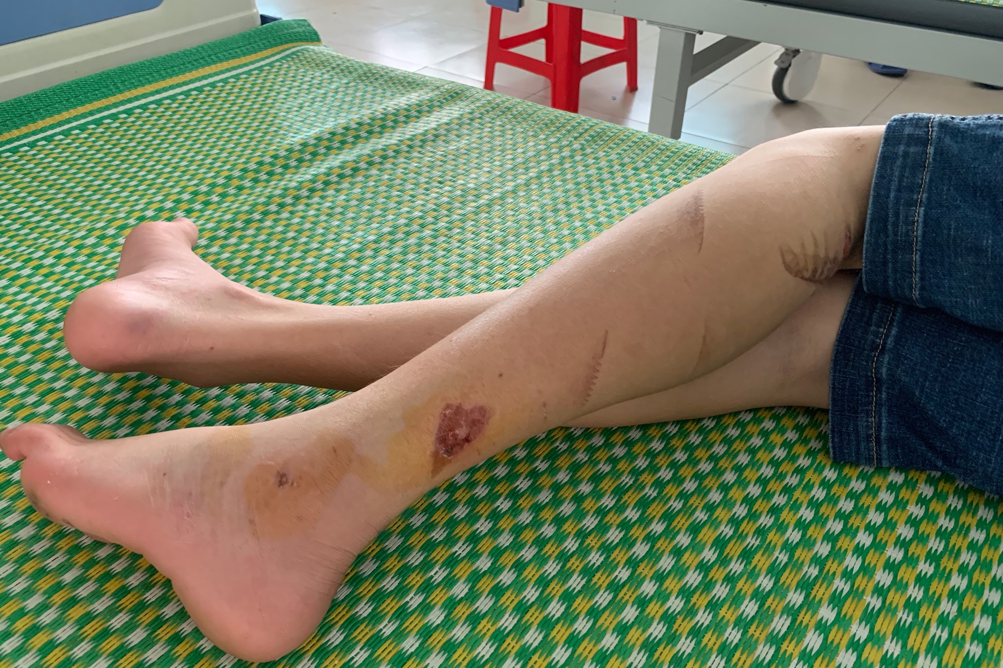 Hanh ha bao hanh 2 nhan vien chay ban anh 1