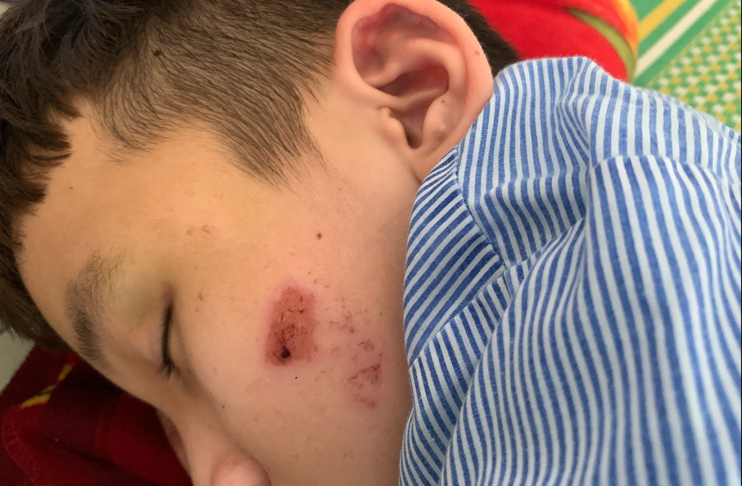 Thieu nien 15 tuoi ke viec bi chu quan banh xeo bao hanh hinh anh