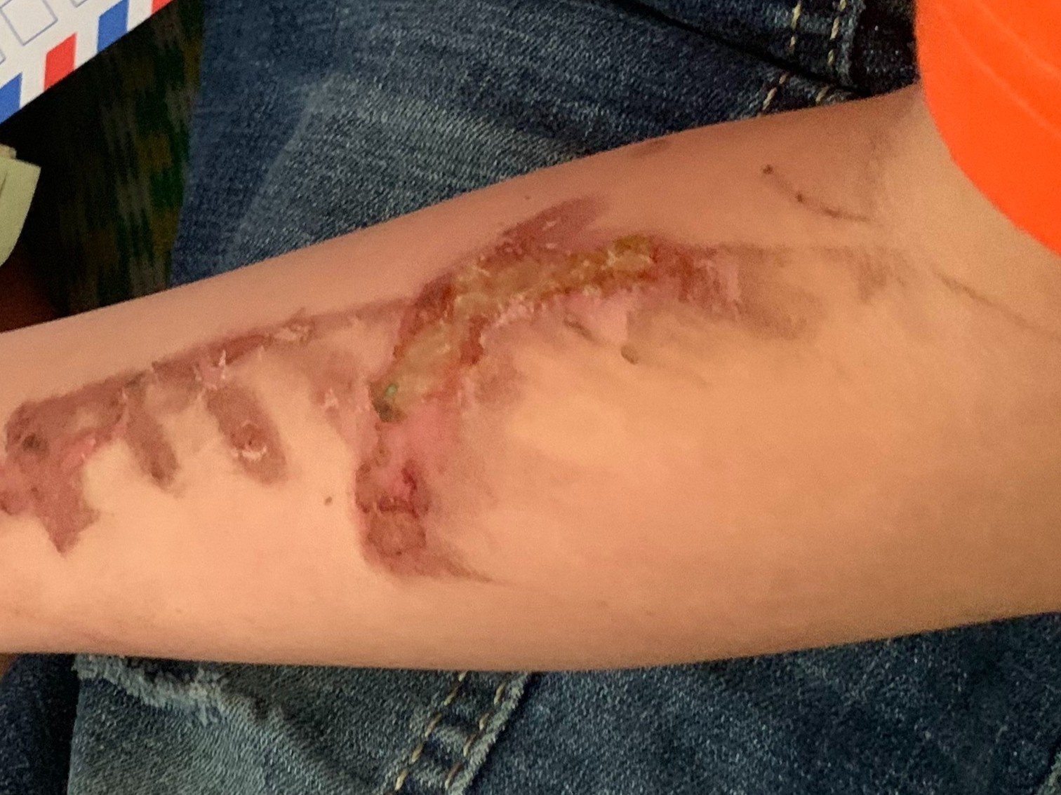 Nguyen nhan chu quan banh xeo bao hanh nhan vien hinh anh