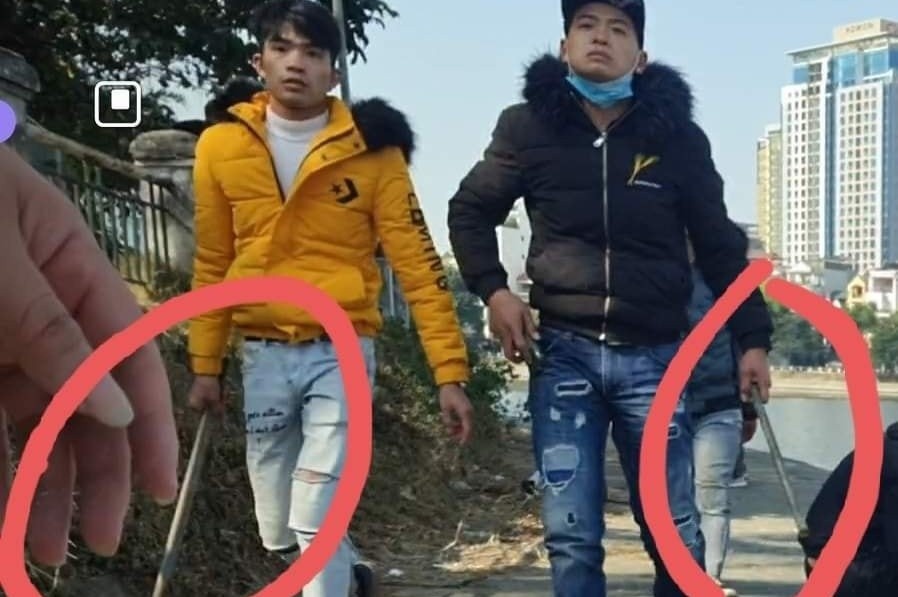 Bị đánh khi đi câu cá ở hồ hoàng cầu ảnh 2 Bi danh khi di cau ca o ho hoang cau anh 2