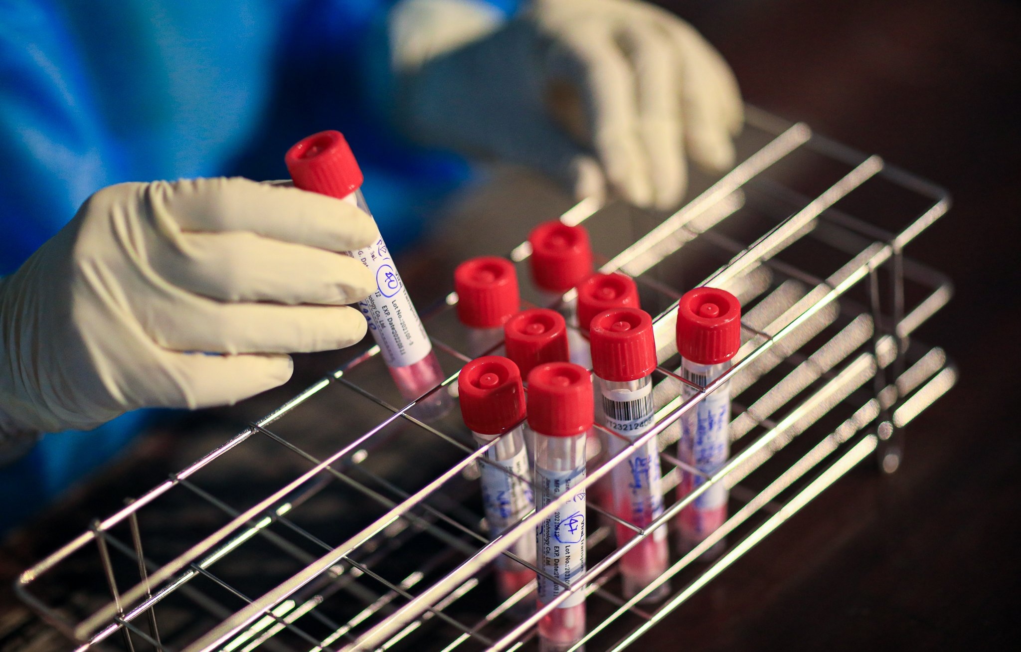 Vi sao so ca mac o mien Tay tang cao anh 1