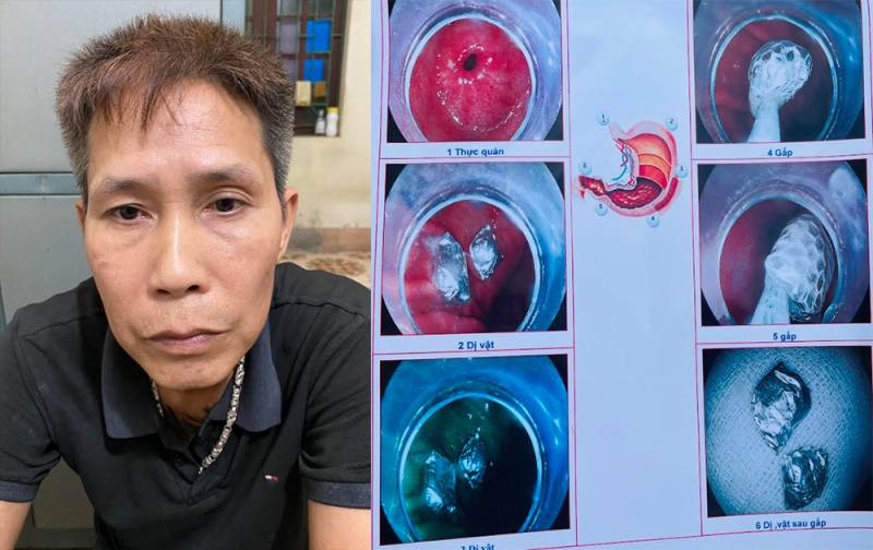 4 nguoi chet sau bua an anh 1