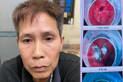 Nuot ma tuy phi tang khi gap cong an hinh anh