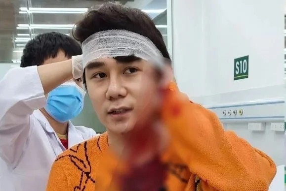 Dien vien Ngo Sy Lam thuong tat 3%, vi sao nghi pham van bi khoi to? hinh anh
