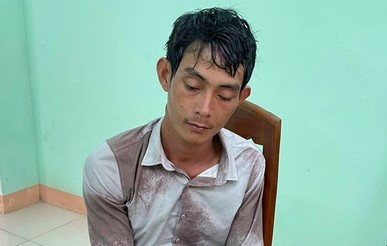 Chong phong xe ruot duoi roi chem vo tu vong hinh anh