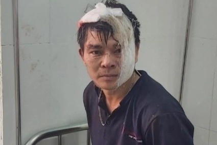 Bi thu chi bo thon bi sat hai hinh anh