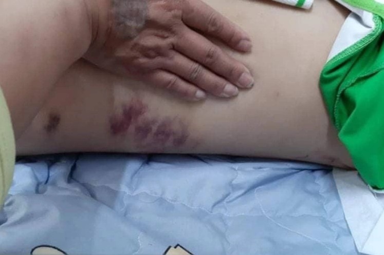 Co gai bi ban trai danh tu vong anh 3