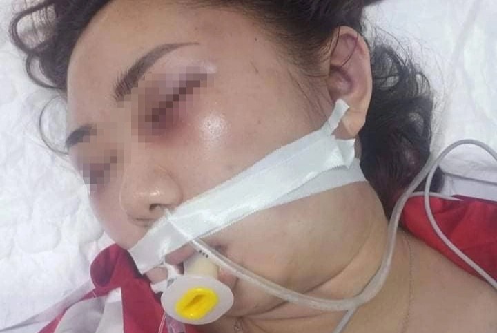 Co gai bi ban trai danh tu vong anh 1