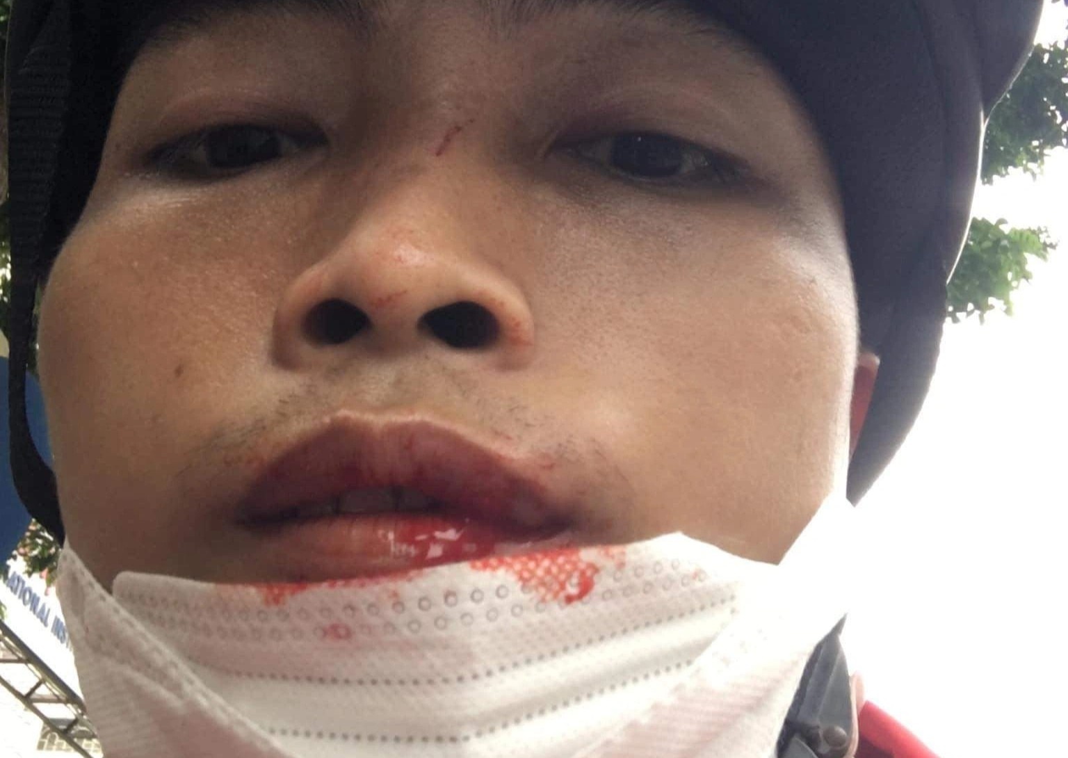 Nam thanh nien to bi tai xe Honda CR-V hanh hung hinh anh