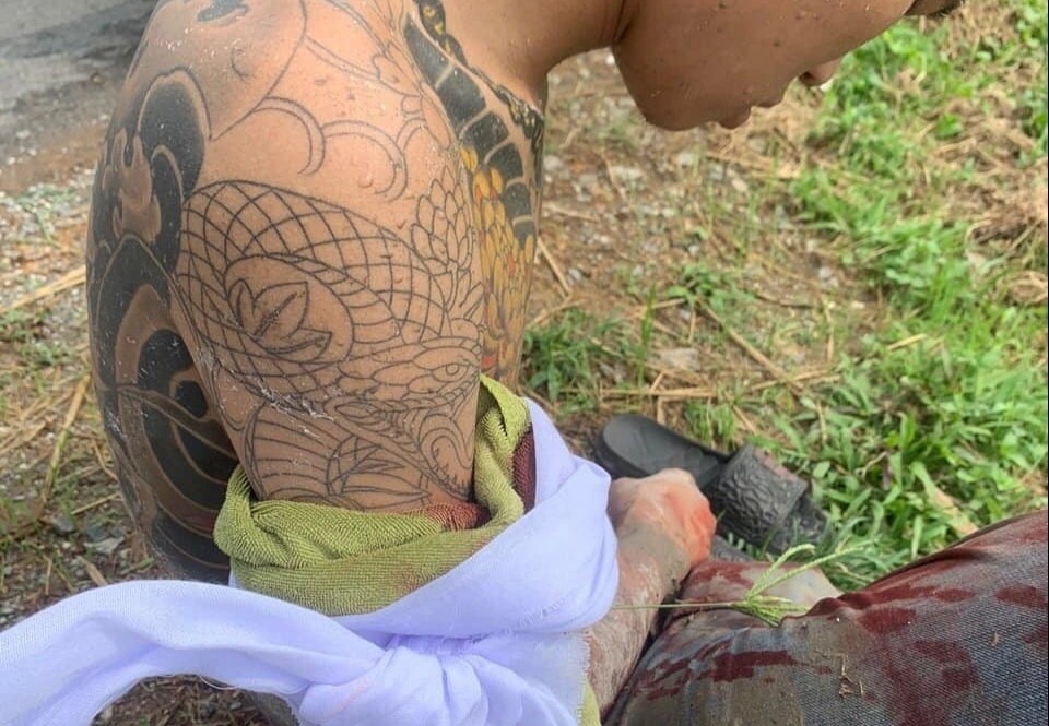 Nam thanh nien bi chem gan dut lia canh tay hinh anh