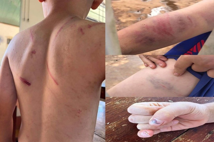 Cháu bé 9 tuổi bị đánh đập ảnh 1 Chau be 9 tuoi bi danh dap anh 1