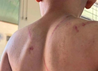 Khoi to ba noi va bo ruot danh dap be trai 9 tuoi o Dak Lak hinh anh