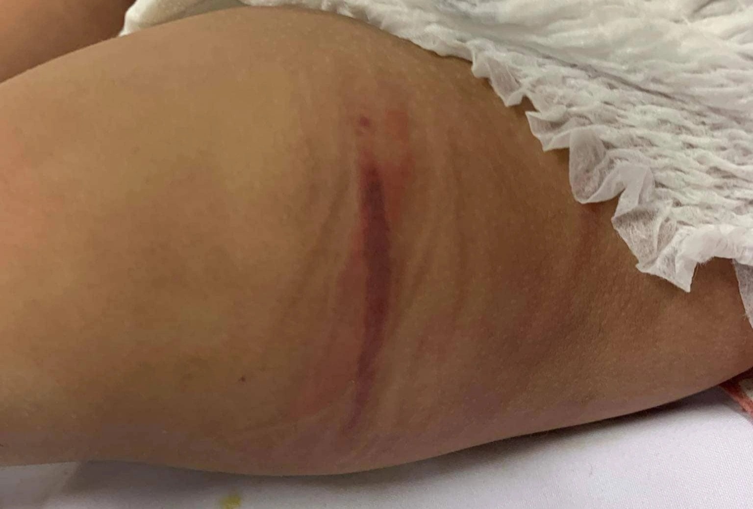 bao hanh chau be 1 tuoi anh 3