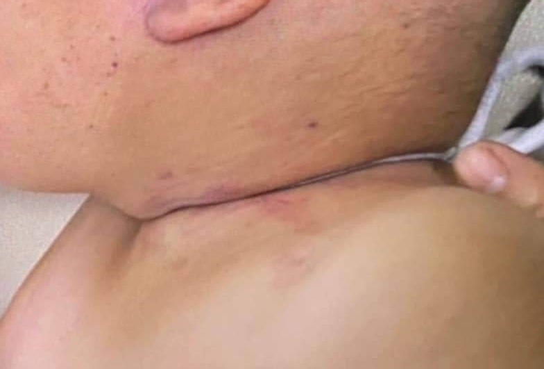 chau be bi nhot trong tu cap dong anh 3